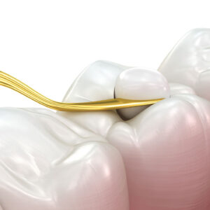 The Science Behind Universal Composites