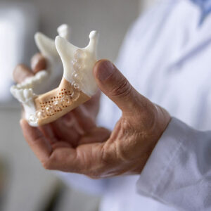 Print the Bone Before You Place the Implant