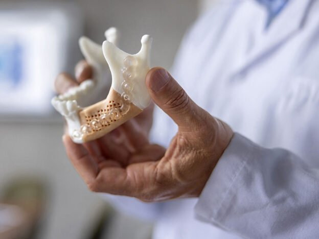 Print the Bone Before You Place the Implant course image